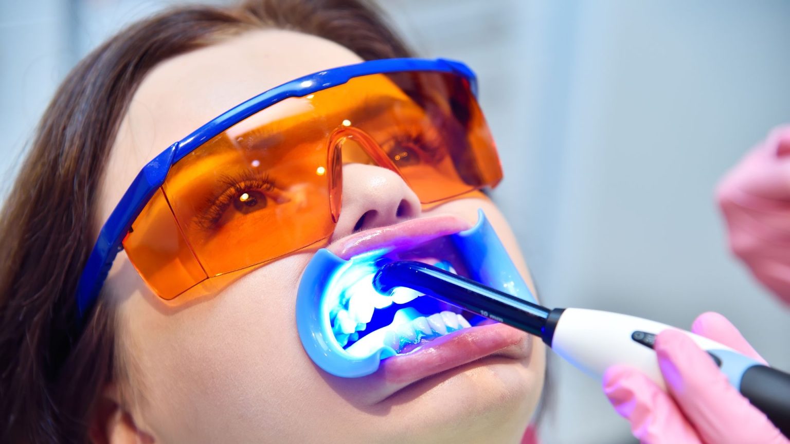Clareamento Dental: Guia Completo sobre Técnicas, Preços e Resultados