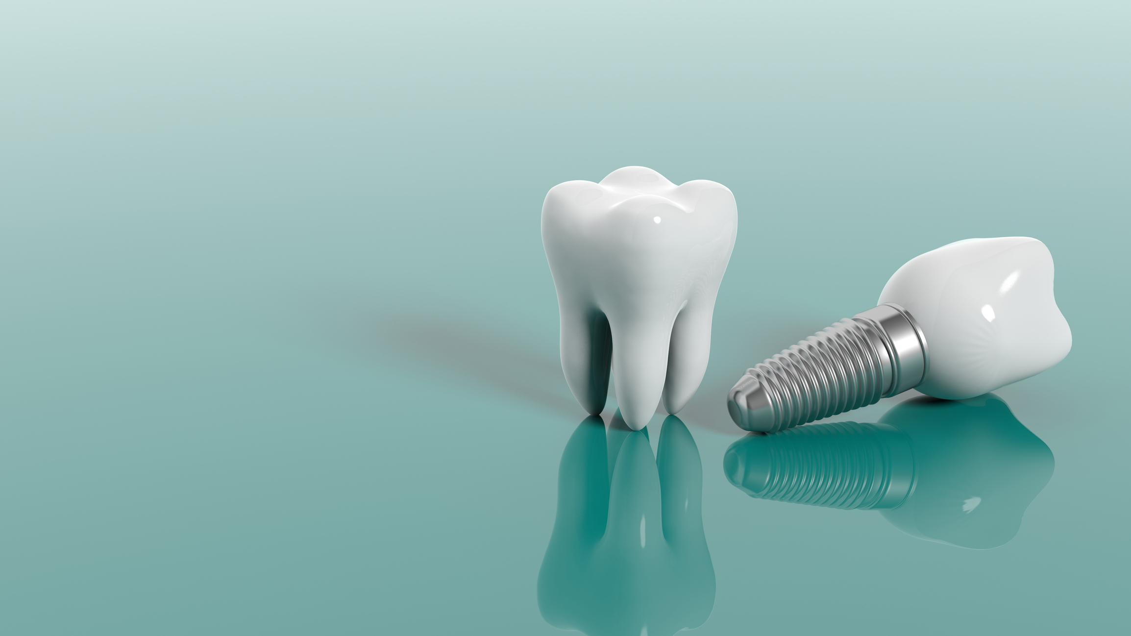 Implantes Dentales: Guía Completa sobre Tipos, Proceso, Beneficios y Costos