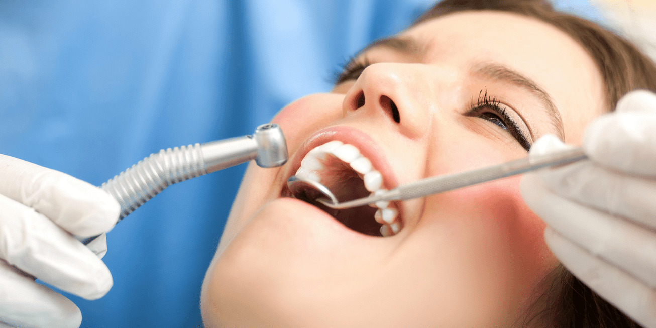 Revisión Dental Gratis: Beneficios, Prevención y Cómo Acceder sin Coste