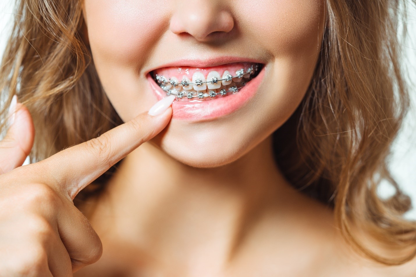 Modern Orthodontics: Braces, Aligners & Lifestyle Tips for a Perfect Smile