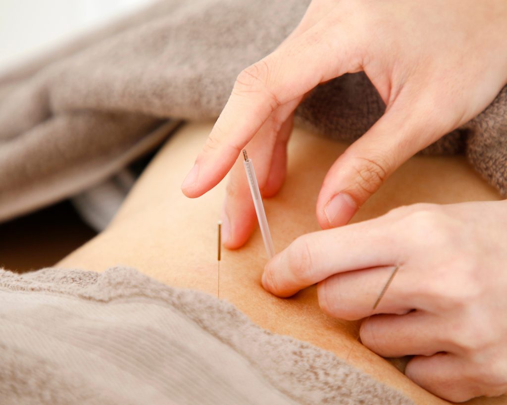 鍼灸と骨格調整で腰椎ヘルニアを根本改善｜自然治癒力を高める保存療法