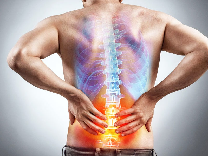 Dermatomyositis: Early Signs, Symptoms, Diagnosis, and Treatment Guide